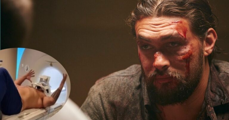 Fans send recovery wishes after Jason Momoa blogs about obtaining an MRI scan.
