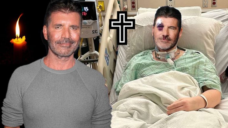 We are saddened to report the tragic accident of “America’s Got Talent” Simon Cowell.