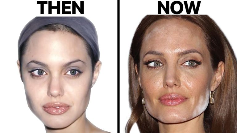 Angelina Jolie NEW FACE | Plastic Surgery Analysis 2023