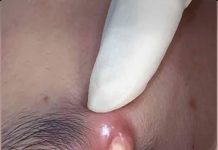 Supreme Court Decision on Veterans’ Disability Claims: Balancing Benefit-of-the-Doubt with Clear-Error Review