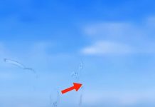 What Are Eye Floaters? do you…