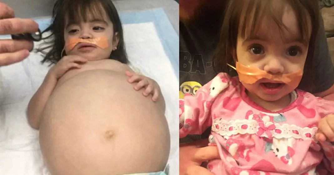 Little girl who looked 8 months’ pregnant because of deadly disease is saved thanks to dad’s kidney donation - featured image