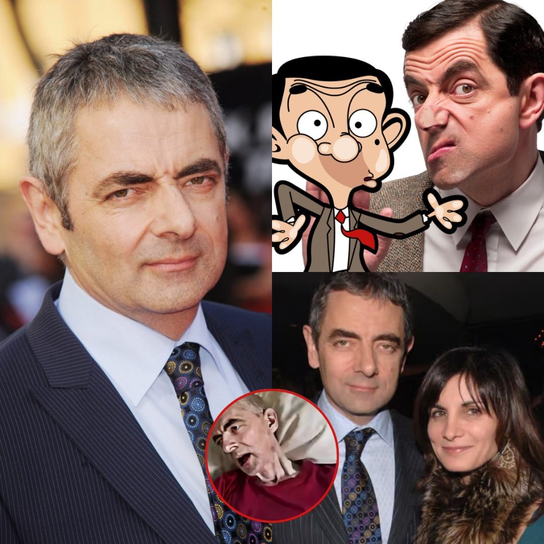 BREAKING: Just half an hour ago, the beloved comedian Rowan Atkinson, famously known as Mr. Bean, was reported by his wife to be courageously facing a serious health challenge at the age of 70… - featured image