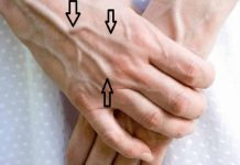 Important Health Tip: What You Need to Know Important Health Tip: What You Need to Know - featured image