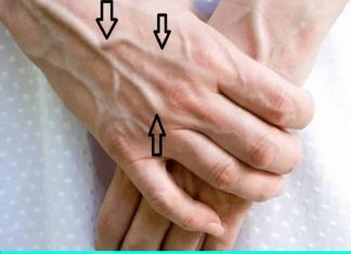 Important Health Tip: What You Need to Know Important Health Tip: What You Need to Know - featured image