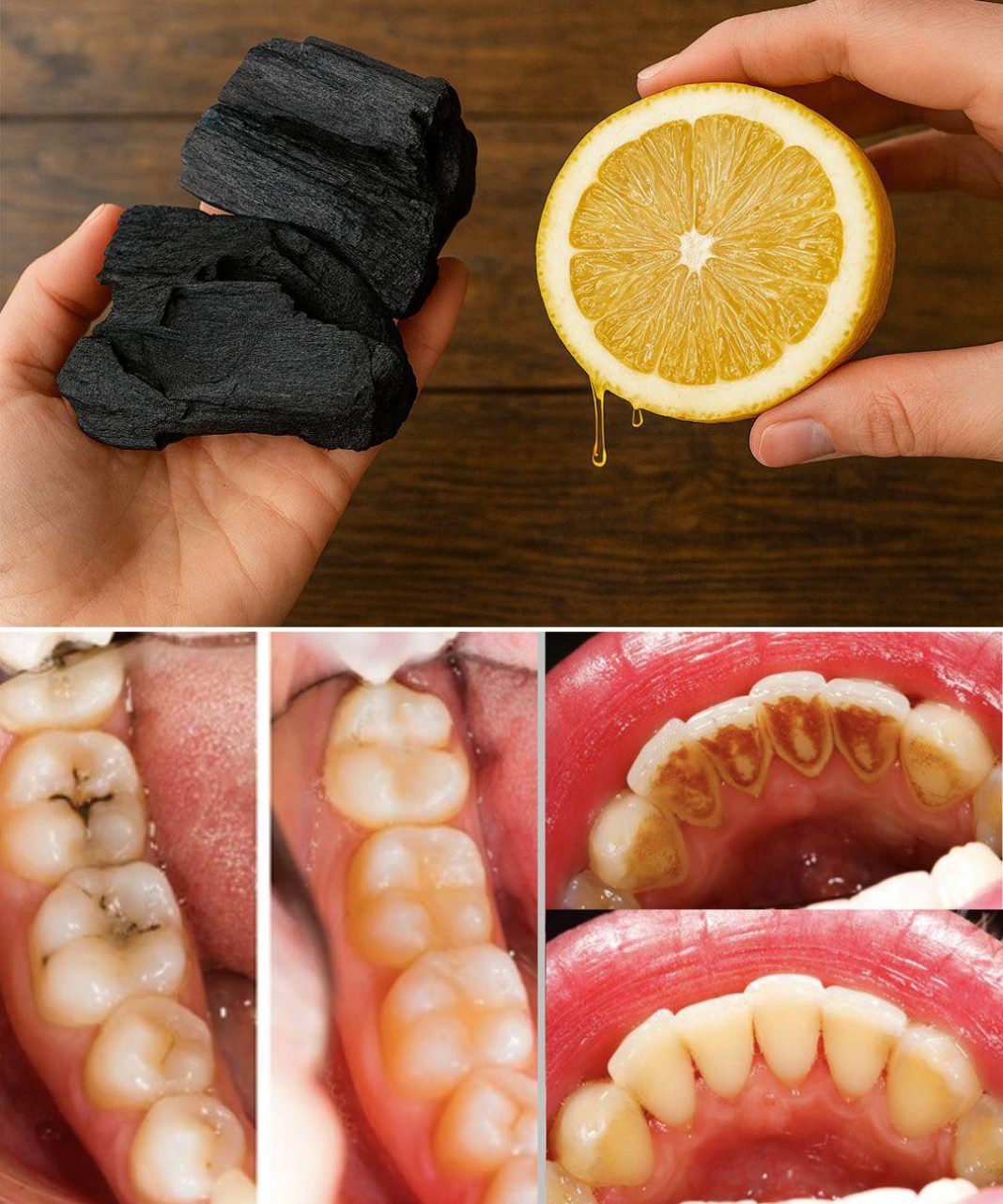 The magic of lemon juice and activated charcoal: Natural DIY solutions for skin and teeth - featured image
