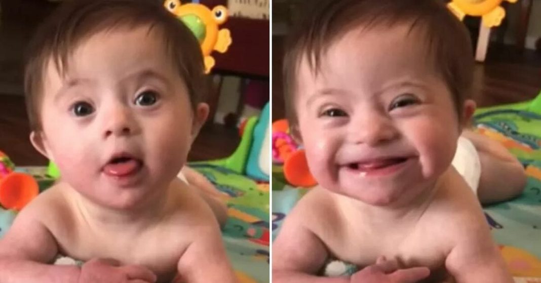 Adopted baby with Down syndrome goes viral after smiling for mom - featured image