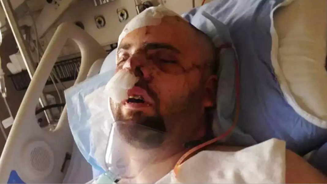 Bear attack survivor wrote chilling final note to loved ones after picking up pieces of his own flesh - featured image