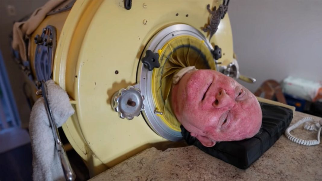 76-year-old man, paralyzed from polio at 6, was one of the last people with an iron lung: ‘My life is incredible’ - featured image