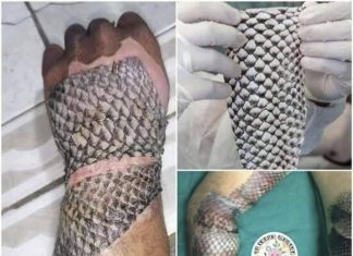 Tilapia Skin: An Innovative Alterna Tilapia Skin: An Innovative Alterna - featured image