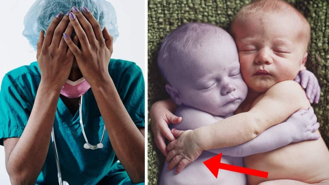 When the nurse placed the l!feless baby beside her healthy twin, she only hoped to say goodbye. But what happened next made her fall to her knees in tears…-TNY - featured image