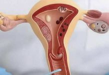 Why going without s*x can be dangerous Why going without s*x can be dangerous - featured image