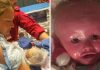 A Baby Girl Who ‘Never Stops Smiling’ Is Living With A Rare Skin Condition That Makes Her Skin Crack A Baby Girl Who ‘Never Stops Smiling’ Is Living With A Rare Skin Condition That Makes Her Skin Crack - featured image