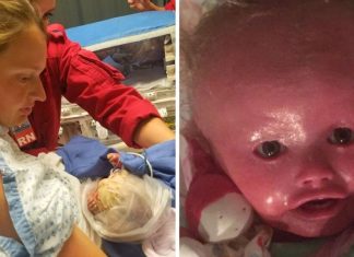 A Baby Girl Who ‘Never Stops Smiling’ Is Living With A Rare Skin Condition That Makes Her Skin Crack A Baby Girl Who ‘Never Stops Smiling’ Is Living With A Rare Skin Condition That Makes Her Skin Crack - featured image