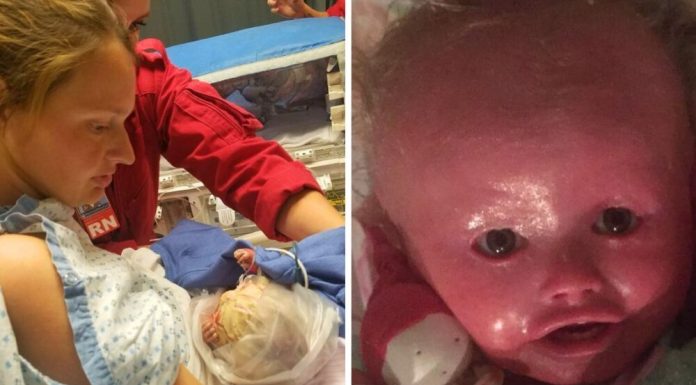 A Baby Girl Who ‘Never Stops Smiling’ Is Living With A Rare Skin Condition That Makes Her Skin Crack A Baby Girl Who ‘Never Stops Smiling’ Is Living With A Rare Skin Condition That Makes Her Skin Crack - featured image