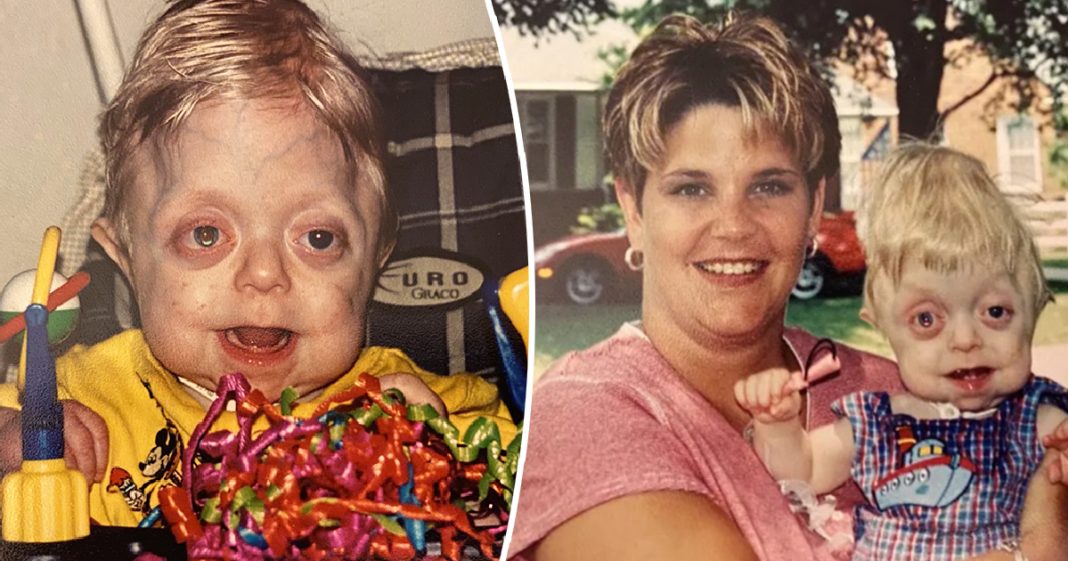 Teen who wasn’t expected to live 18 months graduates high school - featured image