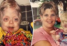 Teen who wasn’t expected to live 18 months graduates high school Teen who wasn’t expected to live 18 months graduates high school - featured image