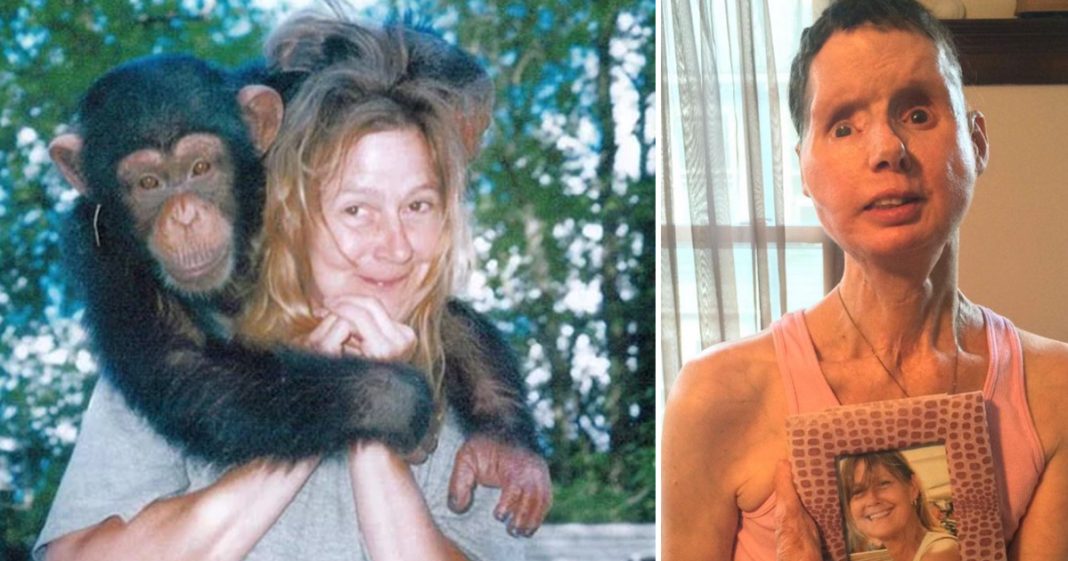 The sad story of Charla Nash, the woman whose face was ripped off by an chimpanzee - featured image The sad story of Charla Nash, the woman whose face was ripped off by an chimpanzee - featured image