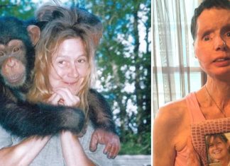 The sad story of Charla Nash, the woman whose face was ripped off by an chimpanzee The sad story of Charla Nash, the woman whose face was ripped off by an chimpanzee - featured image
