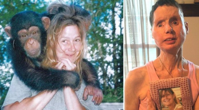 The sad story of Charla Nash, the woman whose face was ripped off by an chimpanzee The sad story of Charla Nash, the woman whose face was ripped off by an chimpanzee - featured image