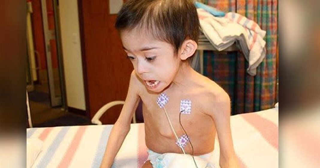 Boy with Down syndrome found starving and locked in attic is reunited with officers who rescued him - featured image