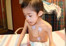 Boy with Down syndrome found starving and locked in attic is reunited with officers who rescued him Boy with Down syndrome found starving and locked in attic is reunited with officers who rescued him - featured image