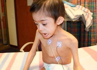 Boy with Down syndrome found starving and locked in attic is reunited with officers who rescued him Boy with Down syndrome found starving and locked in attic is reunited with officers who rescued him - featured image