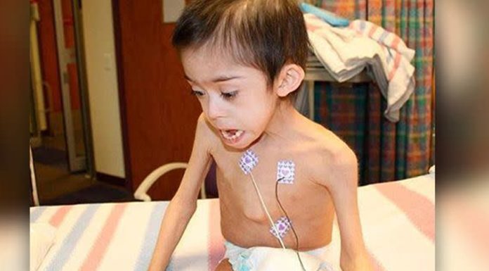 Boy with Down syndrome found starving and locked in attic is reunited with officers who rescued him Boy with Down syndrome found starving and locked in attic is reunited with officers who rescued him - featured image