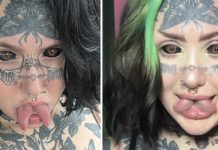 Orylan spent $70K on extreme makeover – shocks with before photos Orylan spent $70K on extreme makeover – shocks with before photos - featured image