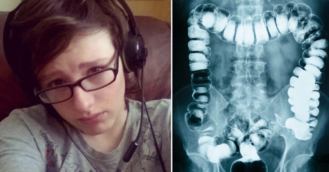 Doctors diagnose teen with constipation, dies 24 hours later - featured image Doctors diagnose teen with constipation, dies 24 hours later - featured image