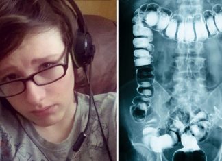 Doctors diagnose teen with constipation, dies 24 hours later Doctors diagnose teen with constipation, dies 24 hours later - featured image