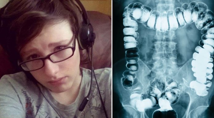 Doctors diagnose teen with constipation, dies 24 hours later Doctors diagnose teen with constipation, dies 24 hours later - featured image