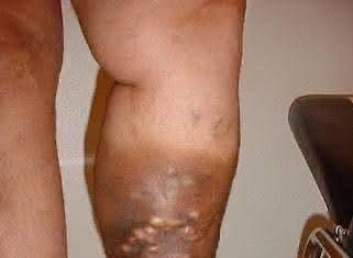 The Quiet Signals Our Bodies Send Long Before We Feel Unwell The Quiet Signals Our Bodies Send Long Before We Feel Unwell - featured image