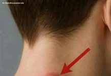 If you get a lump on your neck, back or behind your ear, it means that… If you get a lump on your neck, back or behind your ear, it means that… - featured image