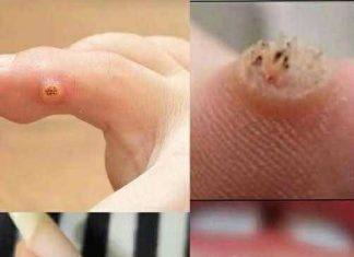 To BE VERY CAREFUL . If you get this, you are infected with …. Check the 1st comment To BE VERY CAREFUL . If you get this, you are infected with …. Check the 1st comment - featured image