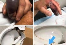 In several regions, while using their toilets, people were attacked In several regions, while using their toilets, people were attacked - featured image