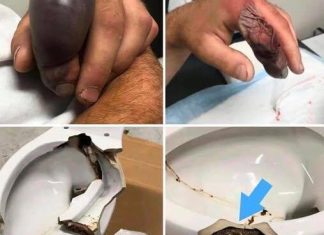 In several regions, while using their toilets, people were attacked In several regions, while using their toilets, people were attacked - featured image