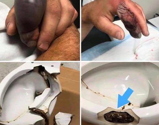 In several regions, while using their toilets, people were attacked - featured image In several regions, while using their toilets, people were attacked - featured image