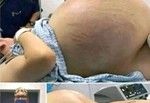 SHE WENT INTO LABOR—BUT WHAT DOCTORS PULLED OUT LEFT THE WHOLE ROOM GASPING (It Wasn’t a Baby!) SHE WENT INTO LABOR—BUT WHAT DOCTORS PULLED OUT LEFT THE WHOLE ROOM GASPING (It Wasn’t a Baby!) - featured image