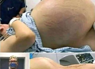 SHE WENT INTO LABOR—BUT WHAT DOCTORS PULLED OUT LEFT THE WHOLE ROOM GASPING (It Wasn’t a Baby!) SHE WENT INTO LABOR—BUT WHAT DOCTORS PULLED OUT LEFT THE WHOLE ROOM GASPING (It Wasn’t a Baby!) - featured image