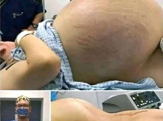 SHE WENT INTO LABOR—BUT WHAT DOCTORS PULLED OUT LEFT THE WHOLE ROOM GASPING (It Wasn’t a Baby!) SHE WENT INTO LABOR—BUT WHAT DOCTORS PULLED OUT LEFT THE WHOLE ROOM GASPING (It Wasn’t a Baby!) - featured image