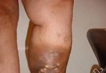 These are the first symptoms of a… See more These are the first symptoms of a… See more - featured image