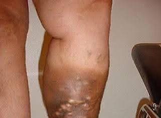 These are the first symptoms of a… See more These are the first symptoms of a… See more - featured image