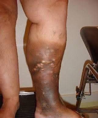 These are the first symptoms of a… See more These are the first symptoms of a… See more - featured image