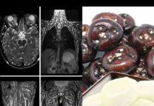 ⚠️ Eating Just One Bite Is Already Harmful — But Many Still Eat It Without Worry ⚠️ Eating Just One Bite Is Already Harmful — But Many Still Eat It Without Worry - featured image