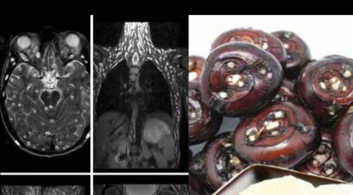 ⚠️ Eating Just One Bite Is Already Harmful — But Many Still Eat It Without Worry ⚠️ Eating Just One Bite Is Already Harmful — But Many Still Eat It Without Worry - featured image