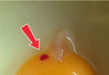 What Red Spots in Eggs Mean — and Whether They’re Safe to Eat What Red Spots in Eggs Mean — and Whether They’re Safe to Eat - featured image