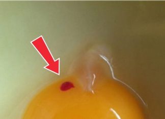 What Red Spots in Eggs Mean — and Whether They’re Safe to Eat What Red Spots in Eggs Mean — and Whether They’re Safe to Eat - featured image