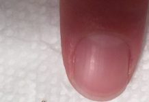 A Simple Guide to Safely Removing an Insect From Your Hair A Simple Guide to Safely Removing an Insect From Your Hair - featured image