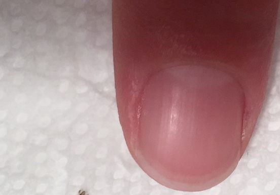 A Simple Guide to Safely Removing an Insect From Your Hair A Simple Guide to Safely Removing an Insect From Your Hair - featured image